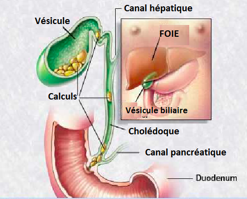 Ablation de la vésicule biliaire : cholécystectomie – Centre de ...