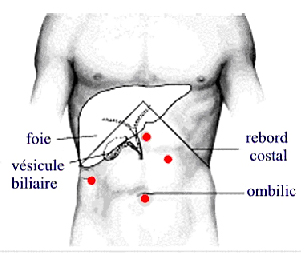 Figure 3 : incisions opératoires