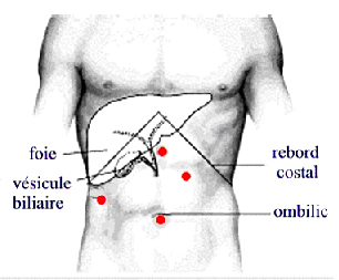 Ablation de la vésicule biliaire : cholécystectomie – Centre de ...